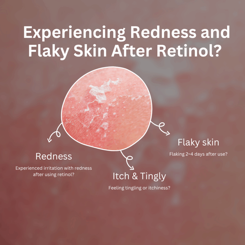 Everything about retinol how to use it without irritatoin