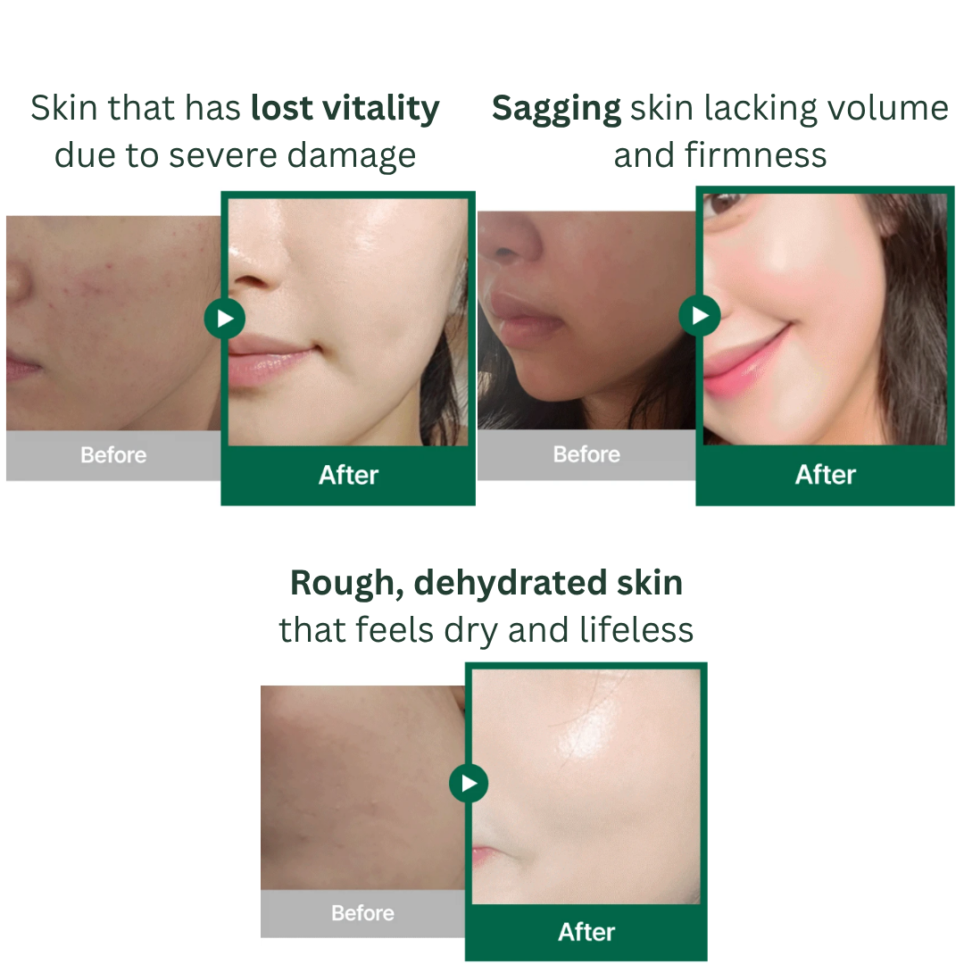 Tender garden Skin Renewal Dual Boosting Set (90ml) + Essence Tablet (1g)