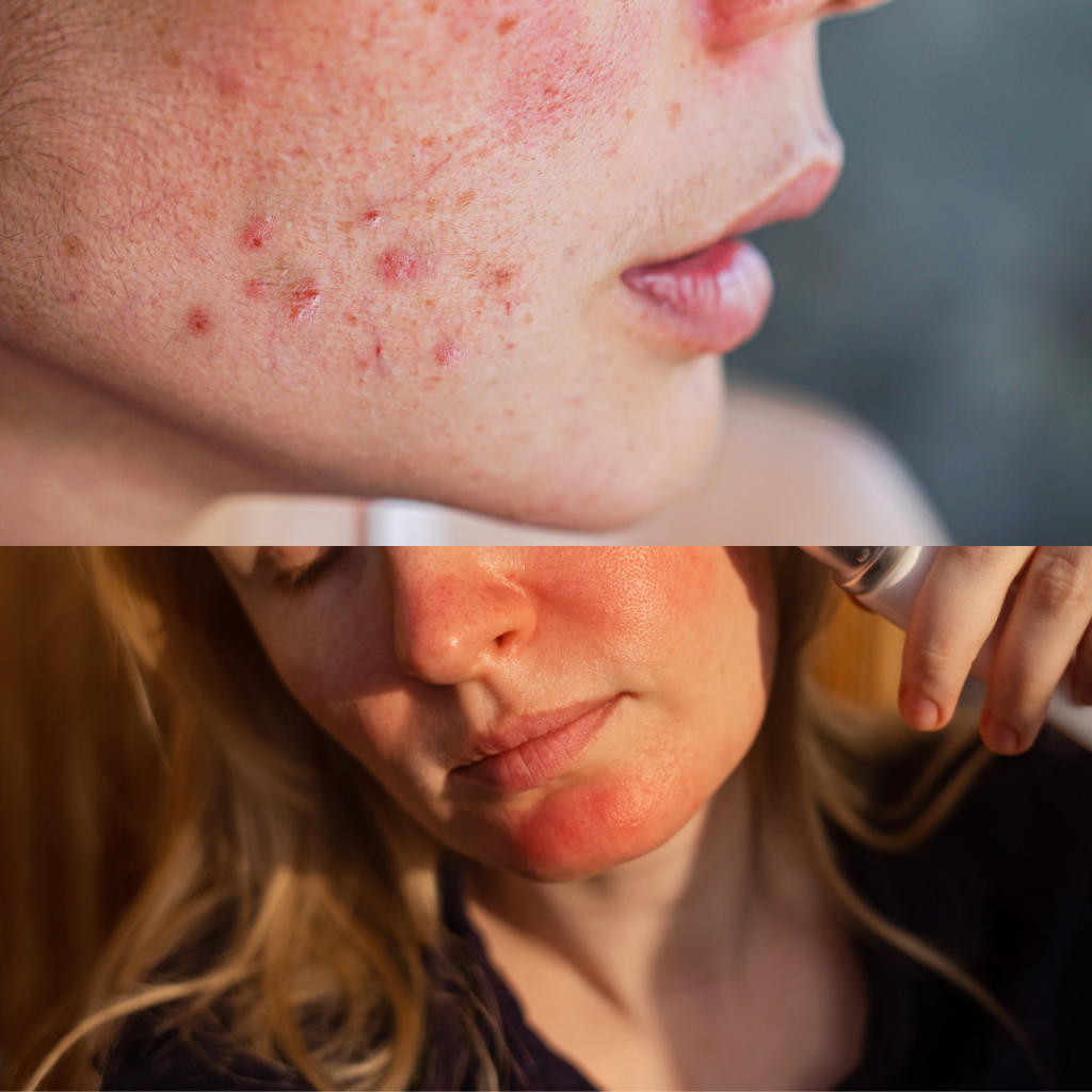Sensitive skin